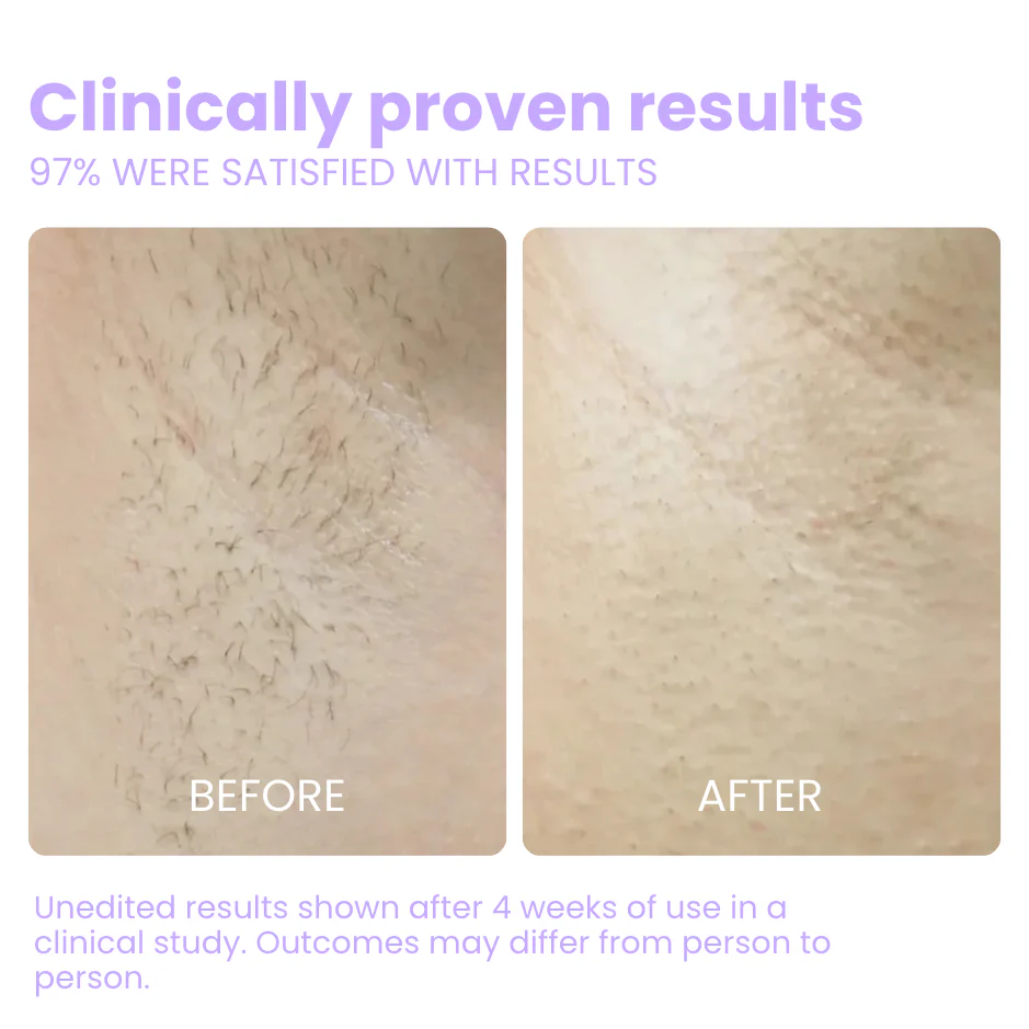 Flair Pro 2.0 IPL Hair Remover