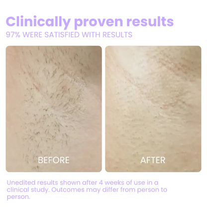Flair Pro 2.0 IPL Hair Remover